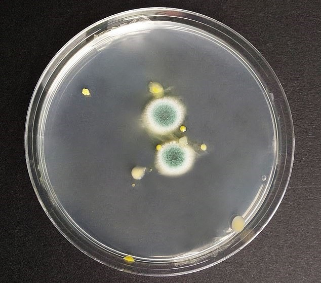Mầm bệnh - loại nấm mốc xanh độc hại đã bắt đầu tích tụ trên túi nilon sau 2 ngày để trong ô tô. Ảnh: Daily Mail.