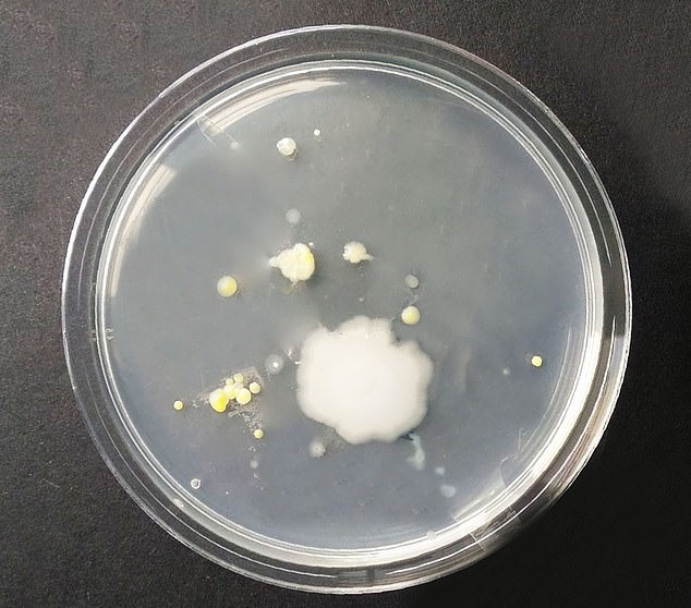 Mầm bênh - nấm men sinh sôi trên ti giả của trẻ em khi để trong ô tô. Ảnh: Daily Mail.