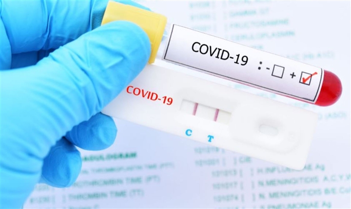 Bộ Y tế khuyến khích người dân ở TP.HCM tự test nhanh COVID-19 tại nhà - 1