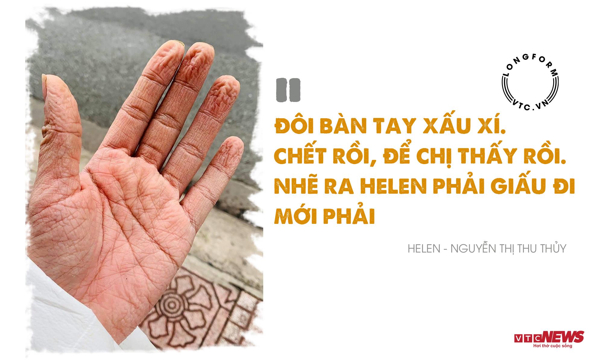 Helen và ‘bàn tay khô cằn’, ‘nhóm lửa’ 26 bếp ăn 0 đồng - 3