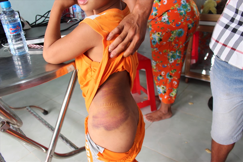 may ma khong co kieu tra dua tro bi danh dau co bi danh do