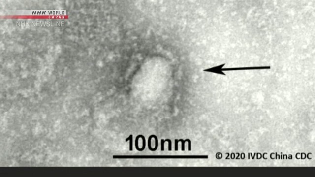 Virus mới có thời gian ủ bệnh trung bình là 7 ngày. Ảnh: NHK.