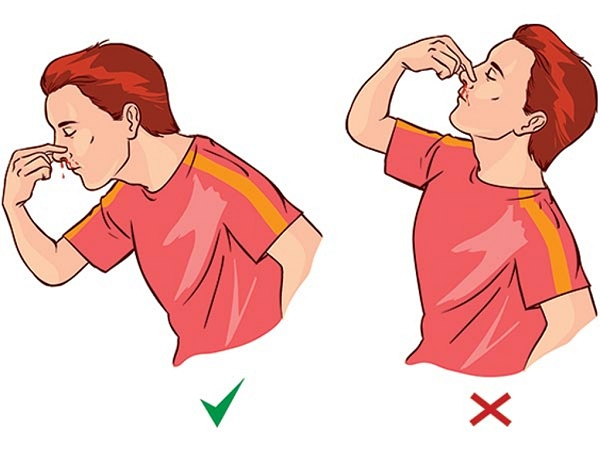 rot cuoc thi khi chay mau cam nen cui mat hay ngua co