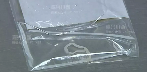 Sán dài 13 cm trong ngực người phụ nữ ăn ếch sống chữa bệnh san dai 13 cm trong nguc nguoi phu nu an ech song chua benh