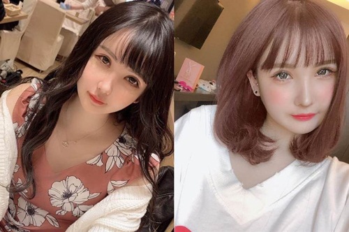 co gai quyet phau thuat tham my chi vi mot cau noi cua bo