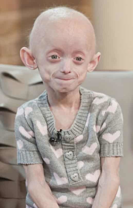 7 can benh quai la ngo nhu chi co trong phim kinh di