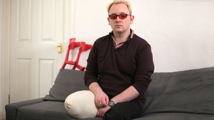 7 can benh quai la ngo nhu chi co trong phim kinh di