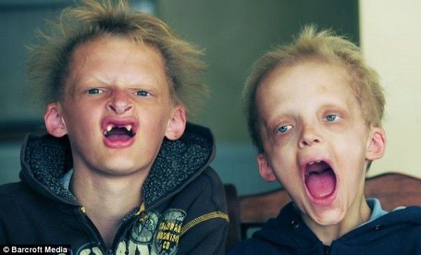 7 can benh quai la ngo nhu chi co trong phim kinh di