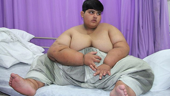 Cậu bé nặng nhất thế giới phải phẫu thuật để sống sót cau be nang nhat the gioi phai phau thuat de song sot