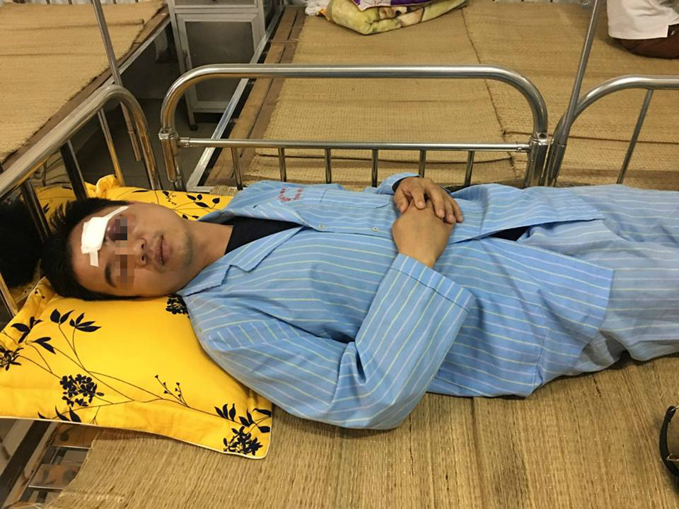 dieu tra vu 6 doi tuong con do chan danh nam nhan vien hang xe mazda