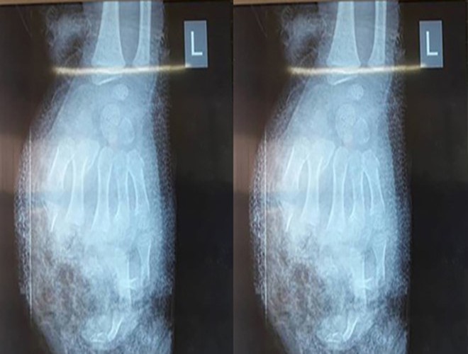 anh nguy hiem chet nguoi cua viec dung dien thoai khi sac