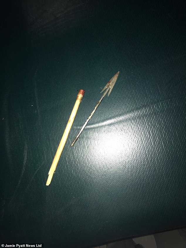 bi mui ten gam trung mat tho san kenya song sot than ky