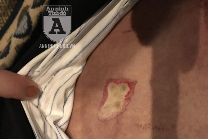 thong tin chinh thuc vu nguoi dan ong tu vong khi thau rua be nuoc ngam