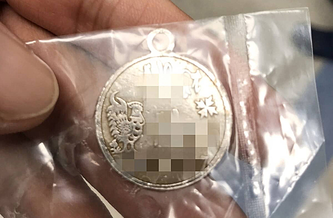 Bé 2 tuổi nuốt mặt dây chuyền to hơn đồng xu be 2 tuoi nuot mat day chuyen to hon dong xu