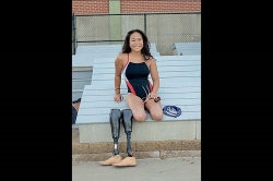 Cô bé khuyết chân vượt qua nghịch cảnh