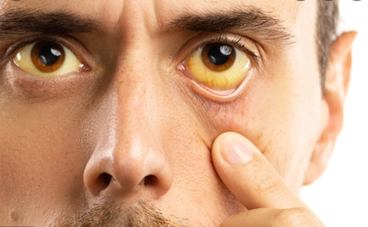 3 dấu hiệu trên da cảnh báo ung thư đang âm thầm phát triển: Nên đề phòng sớm - 2