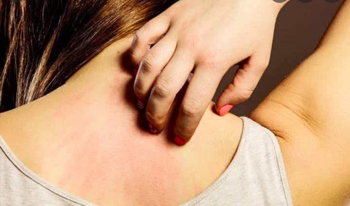 3 dấu hiệu trên da cảnh báo ung thư đang âm thầm phát triển: Nên đề phòng sớm - 3