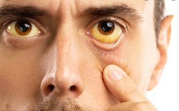 3 dấu hiệu trên da cảnh báo ung thư đang âm thầm phát triển: Nên đề phòng sớm