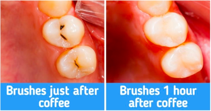 Bí quyết đơn giản để sở hữu hàm răng trắng khỏe, giảm sâu răng, tránh hôi miệng - 3