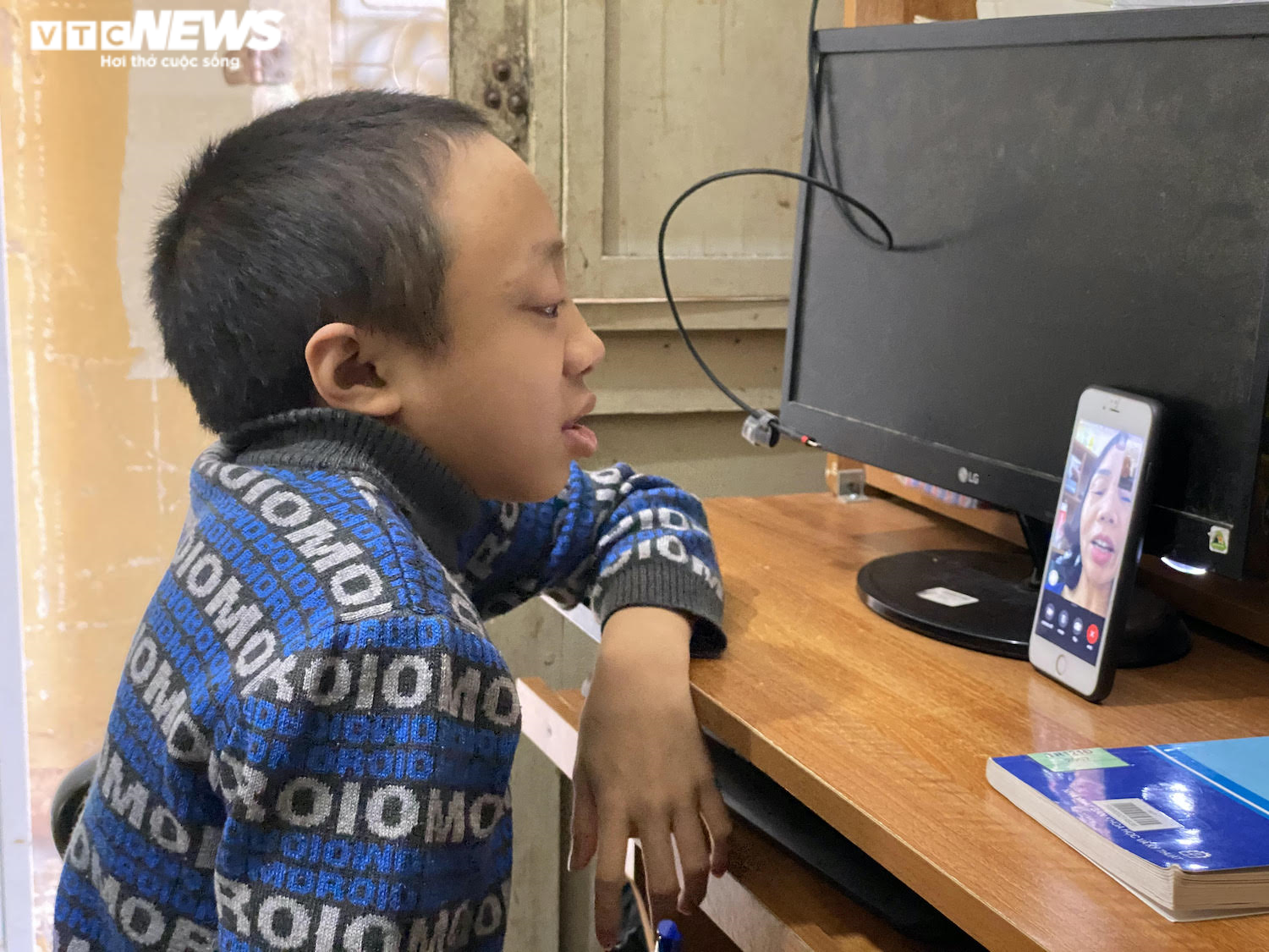 Hành trình 18 năm chiến đấu với bệnh xương thuỷ tinh của nam sinh ĐH Bách khoa - 2