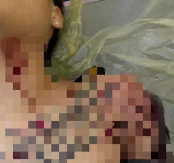 Khởi tố vụ án nổ súng khiến nam thanh niên trọng thương ở Thái Bình