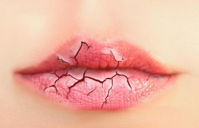 6 thói quen xấu khiến đôi môi nứt nẻ, khô xác - 1
