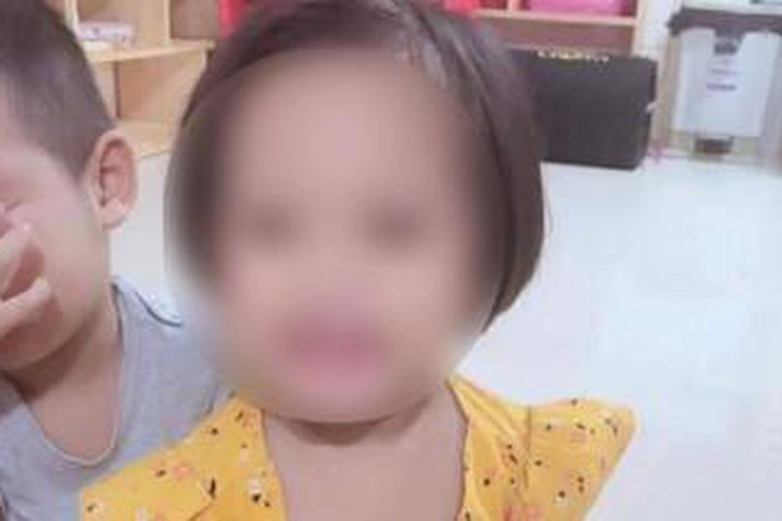 Cảnh sát hình sự Hà Nội đã tiếp nhận hồ sơ vụ phát hiện 9 vật thể lạ trong sọ bé gái 3 tuổi hôn mê