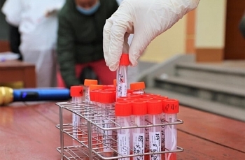 31 người từ địa phương khác về Hà Nội nhiễm SARS-CoV-2 dù tiêm đủ 2 liều vaccine