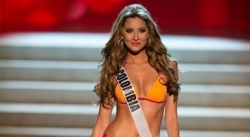 Cựu hoa hậu Colombia phải cưa chân