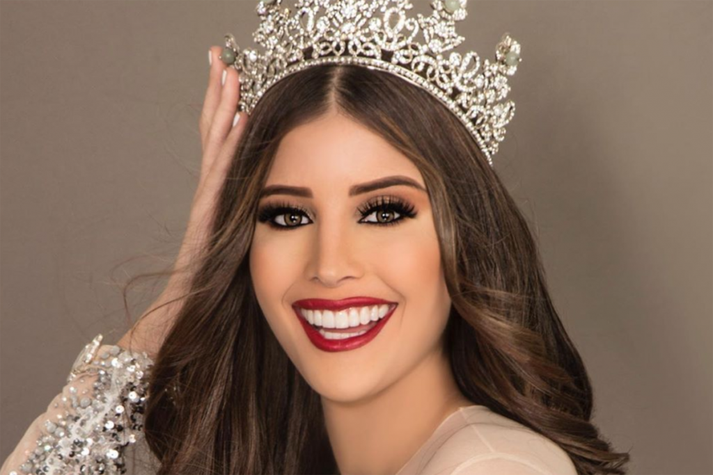 Nhan sắc Hoa hậu Trái đất Venezuela 2020