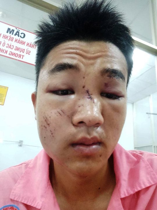 va vao gay csgt mot nguoi gay xuong ham