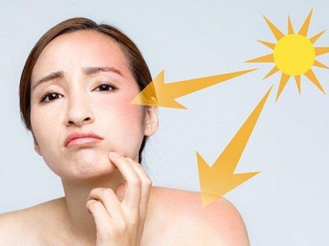 Tia UV ảnh hưởng nghiêm trọng đến sức khỏe làn da.