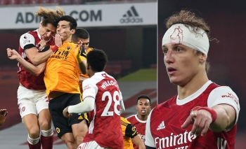 David Luiz khiến đối phương nứt hộp sọ sau pha va chạm kinh hoàng