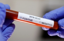 ngay thu 12 viet nam khong co ca lay nhiem covid 19 trong cong dong