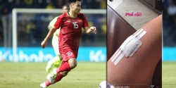 Đức Huy chấn thương, HLV Park Hang Seo thêm nỗi lo trước đại chiến Việt Nam vs Thái Lan