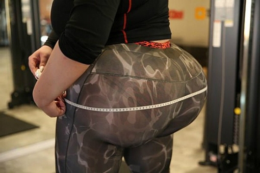 Cô gái phẫu thuật bơm mông liên tục để có vòng ba khủng