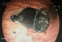 Cô gái có hai tượng Phật nằm trong bụng