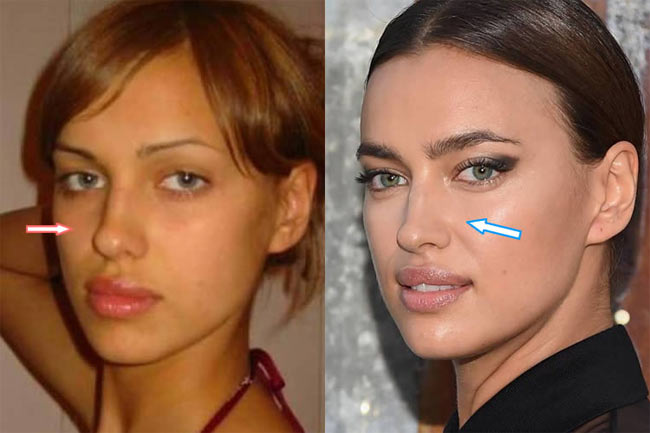 khuon mat hoan my khuon nguc goi cam cua irina shayk la tu nhien hay nhan tao